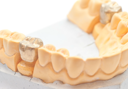 colocación de implantes dentales